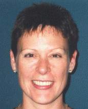 Susan Young